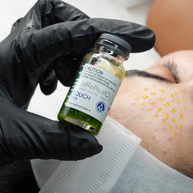 BioRePeel Package at Brow Boss Beauty Bar in Fort Lauderdale, FL